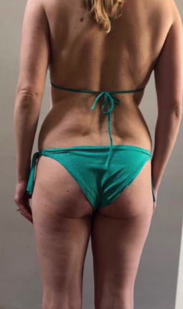 After image 1